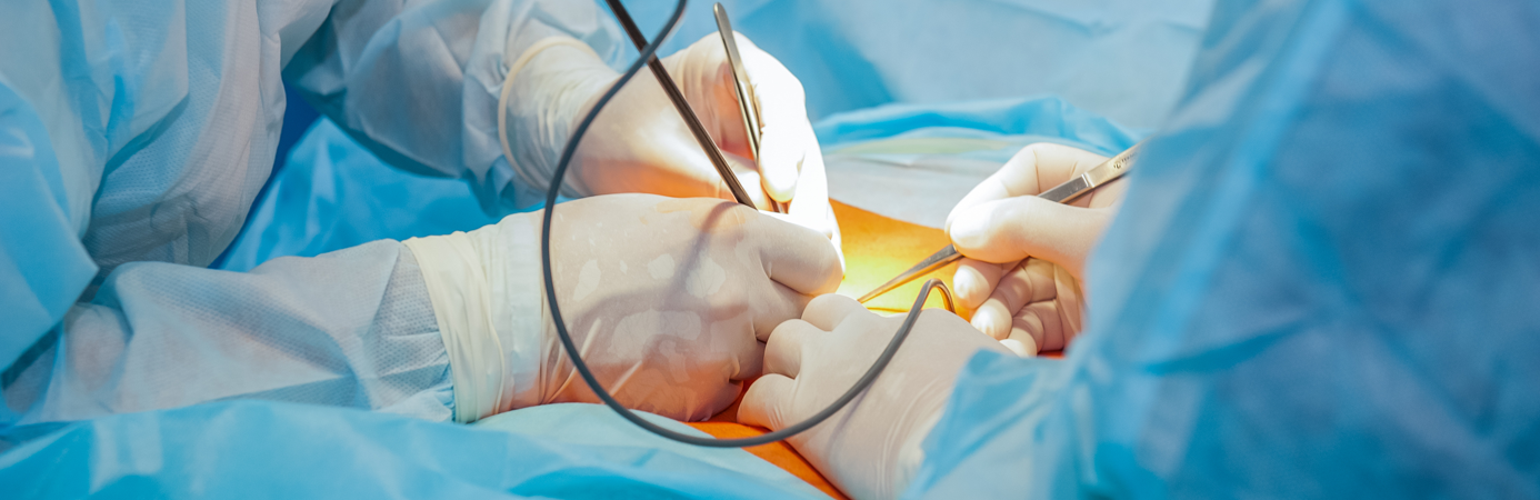 Advantages of Laparoscopic Hernia Surgery