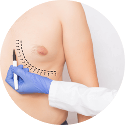 Increase in the diameter of the areola
